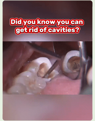 Fluoride-Free Hydroxyapatite Toothpaste